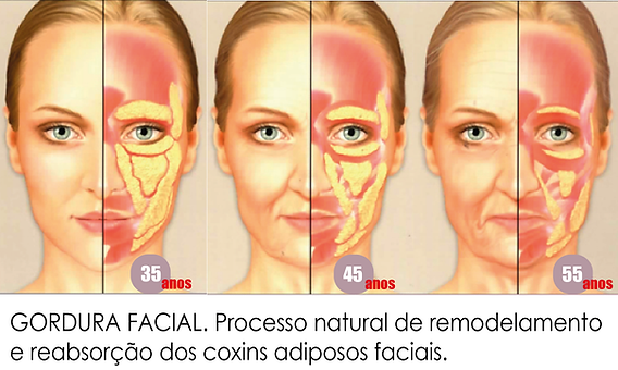Sol Sem Proteção: O Vilão Invisível - inspiração 2