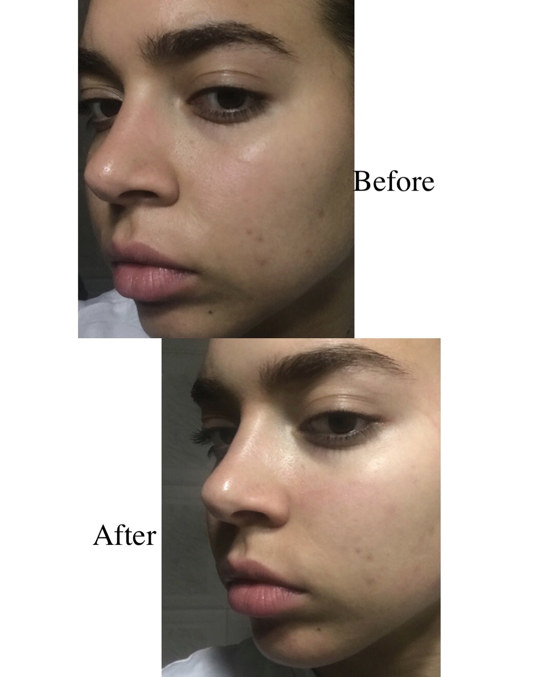 Movimentos Específicos Para o Contorno dos Olhos e Malar - inspiração 2