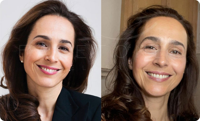 Como Integrar o Pilates Facial na Sua Rotina Diária - inspiração 2