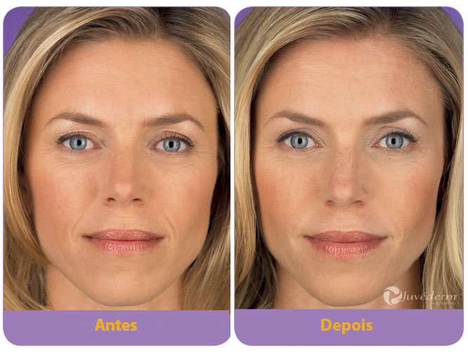 Resultados Realistas: O Que Esperar e Quando? - inspiração 1