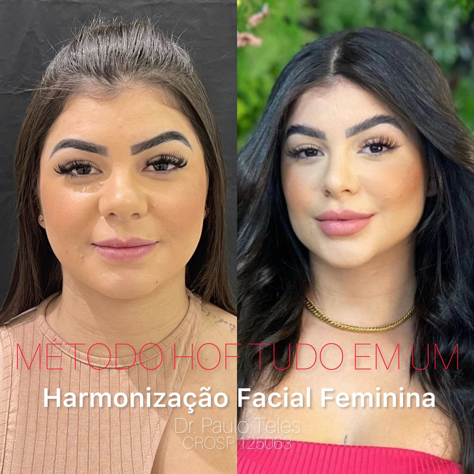 Resultados Realistas: O Que Esperar e Quando? - inspiração 2