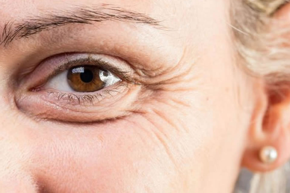 Estresse e a Pele: Como Gerenciar para uma Aparência Jovem - inspiração 1