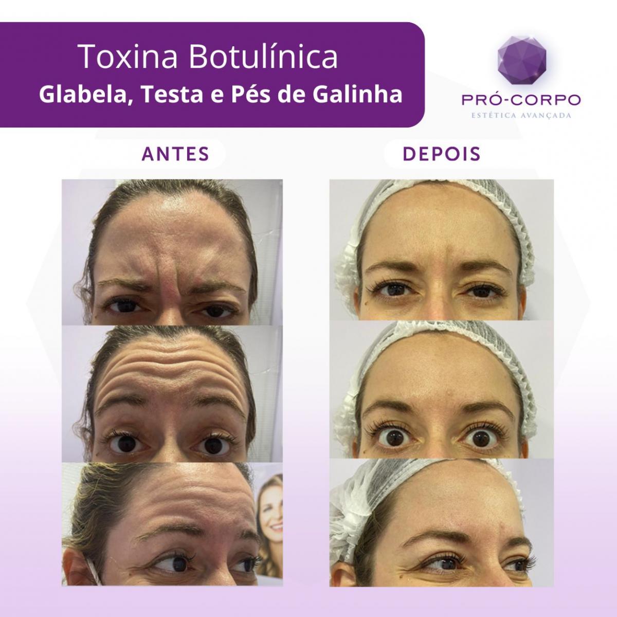 Alimentação Consciente: Nutrição que Reflete na Pele - inspiração 2