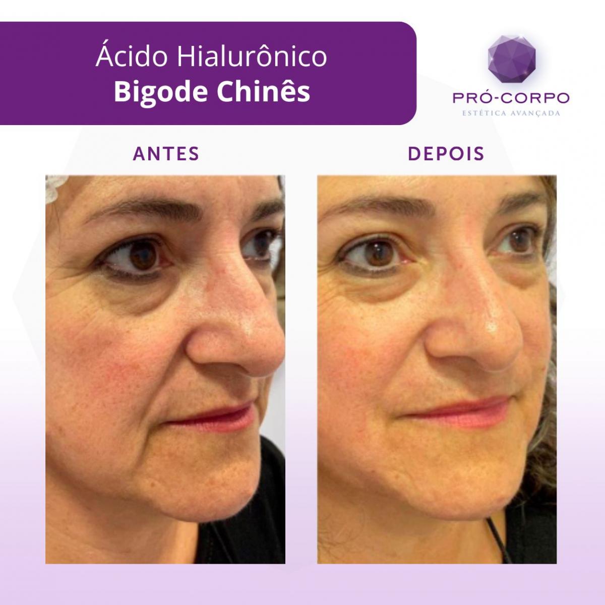 Evitando Hábitos Nocivos: Impacto Direto na Pele - inspiração 1