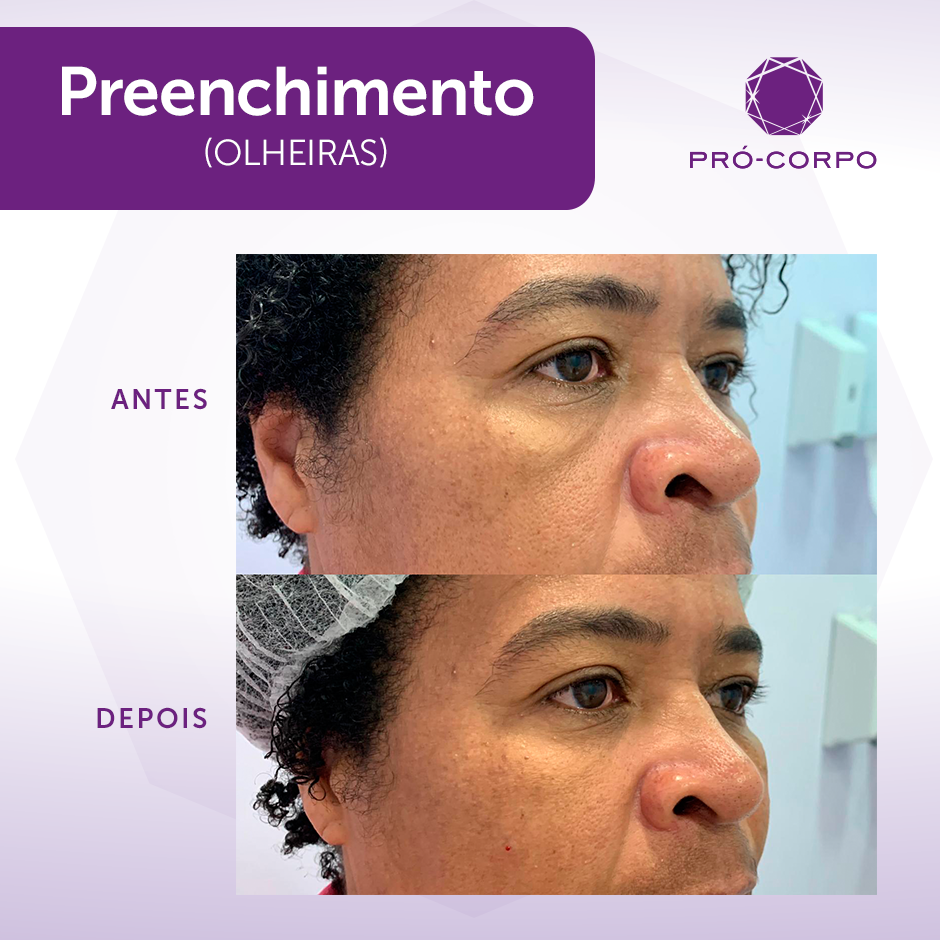 Tratamentos Caseiros que Realmente Funcionam: Ingredientes Naturais em Ação - inspiração 2