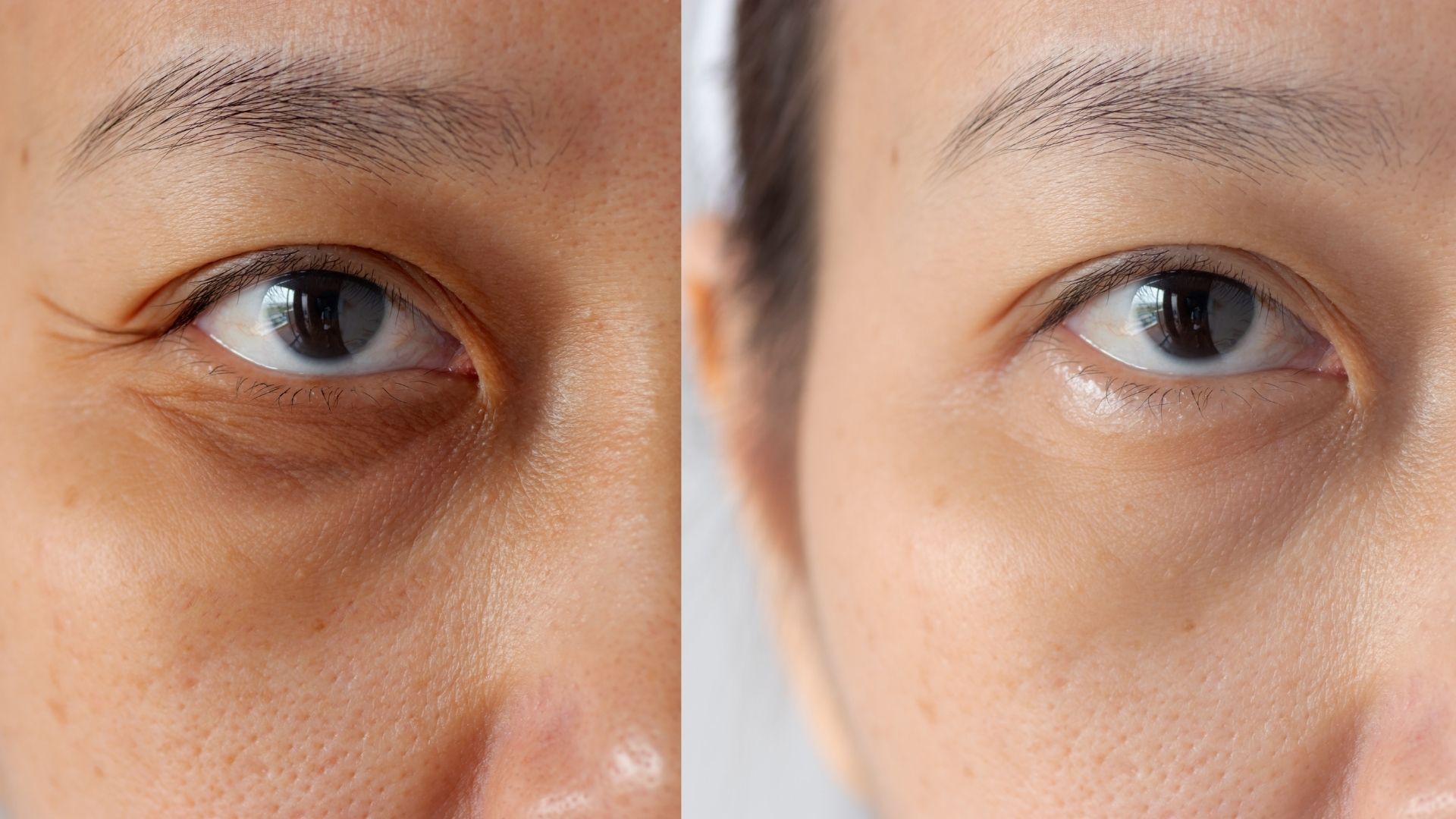 O Impacto da Alimentação e Hidratação na Aparência da Sua Pele - inspiração 1