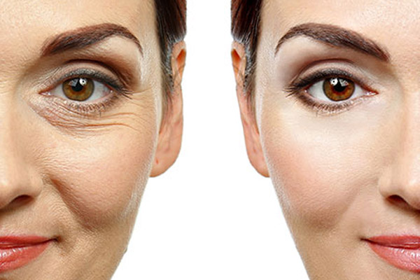 Procedimentos Estéticos: Opções Para Resultados Mais Rápidos e Visíveis - inspiração 1