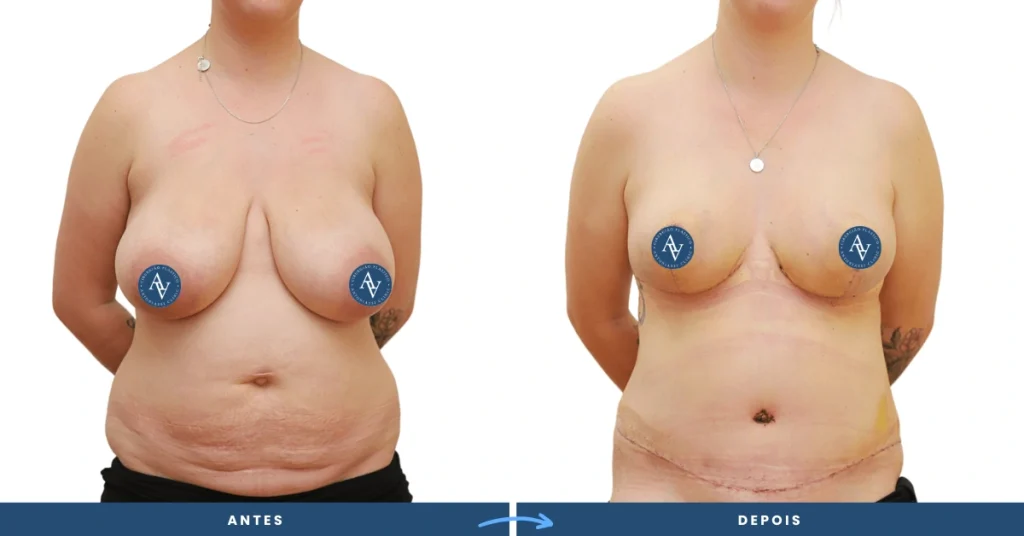 Adeus Frizz: Técnicas para Controlar e Suavizar Sem Silicones - inspiração 2