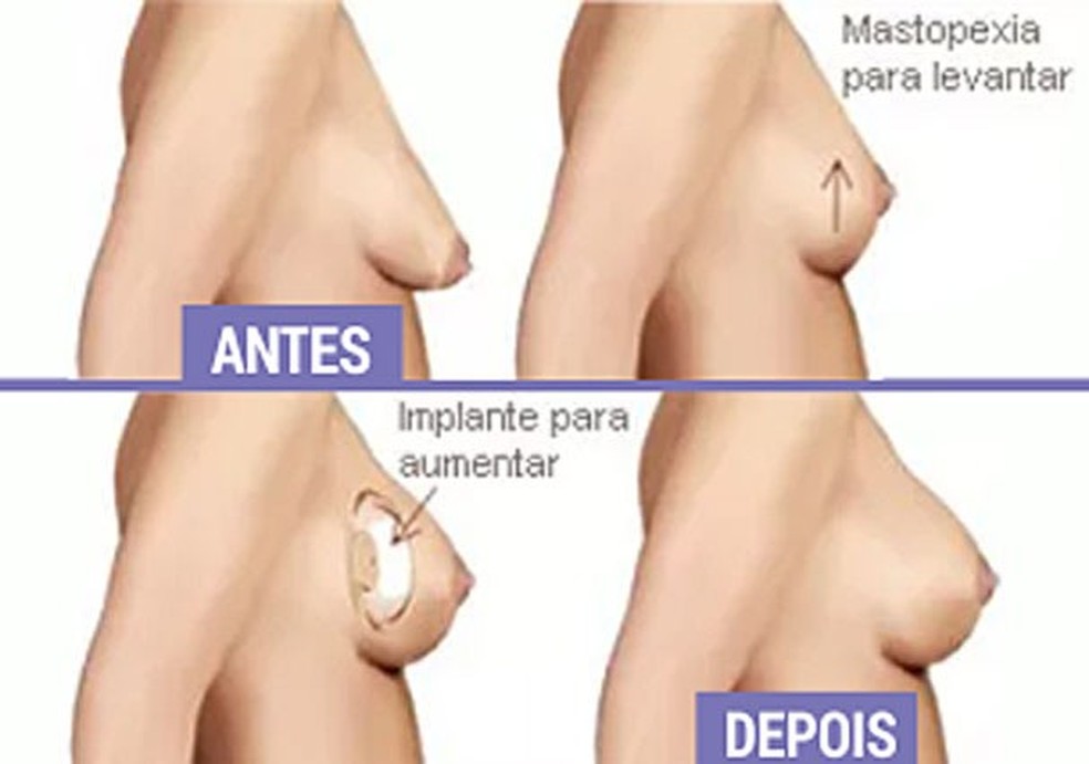 Maquiagem: A Base Perfeita e Luminosa sem Silicone - inspiração 1