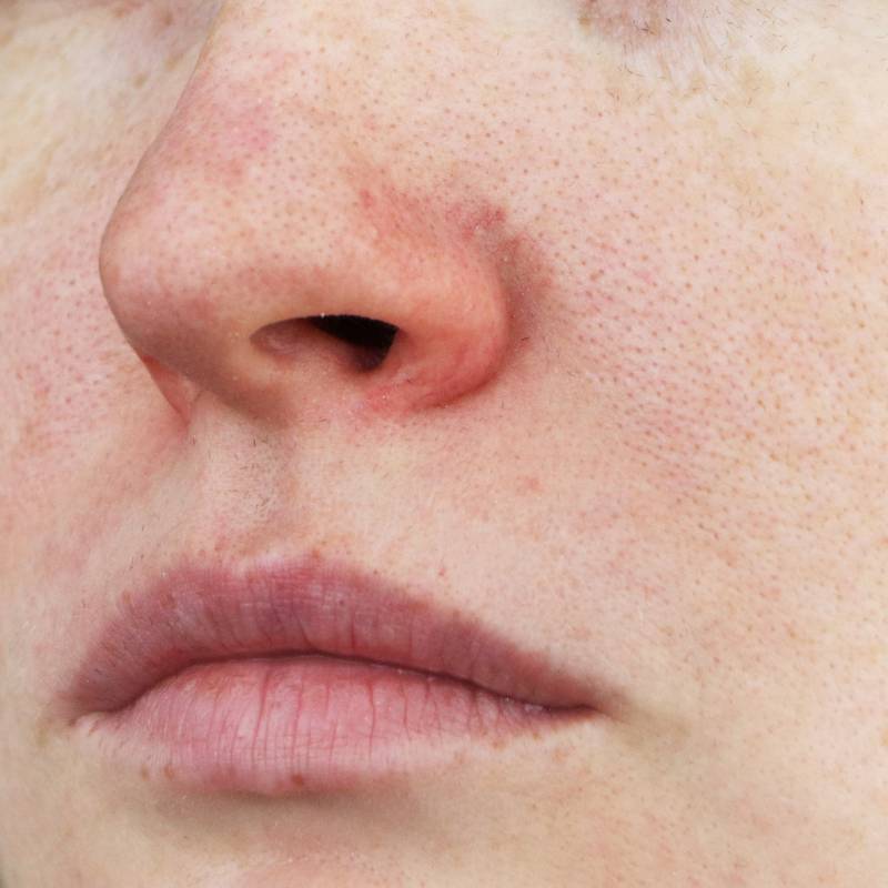 Fatores Externos Que Transformam Sua Textura de Pele - inspiração 2