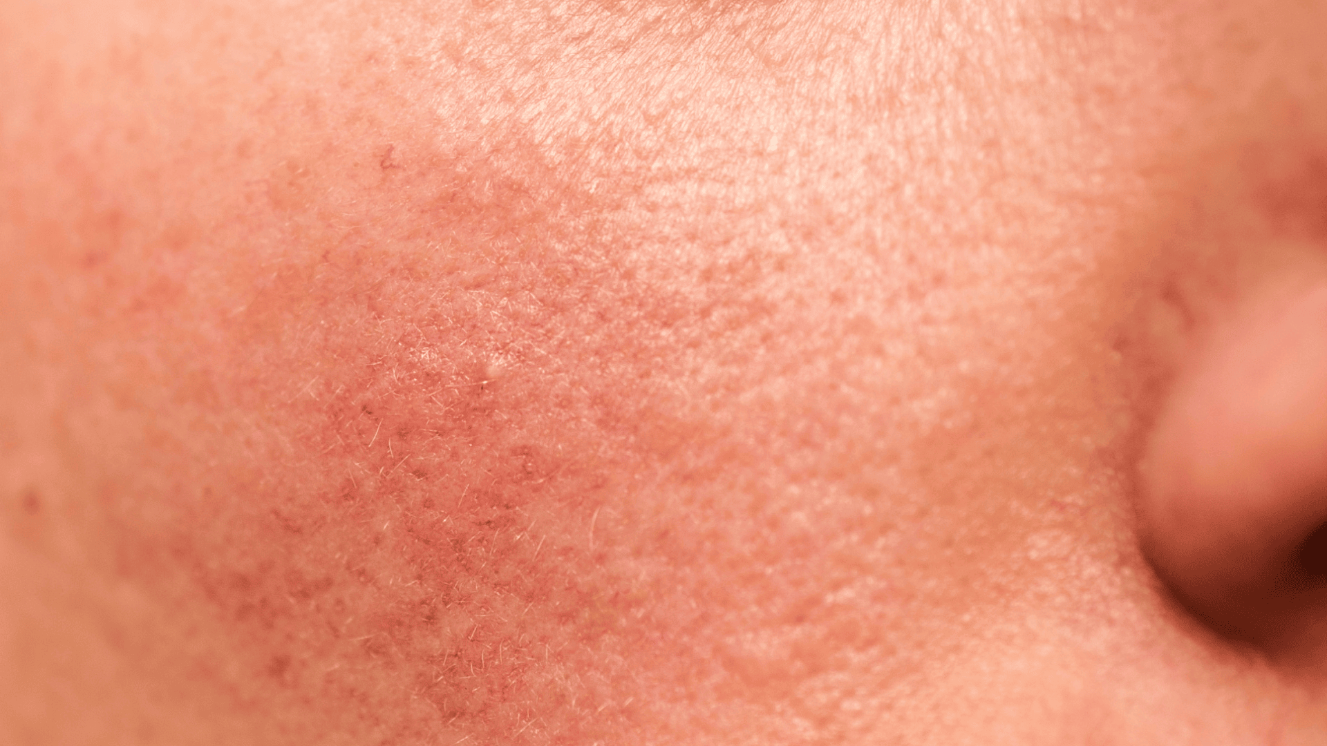 Mitos e Verdades Sobre o Aprimoramento da Textura da Pele - inspiração 2