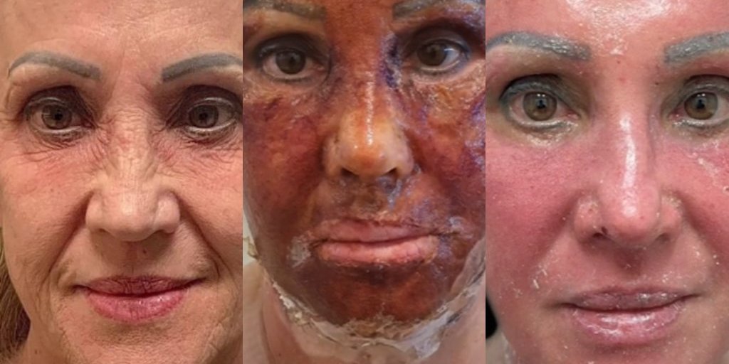 Ácido Hialurônico: O Hidratante Poderoso para sua Pele - inspiração 1