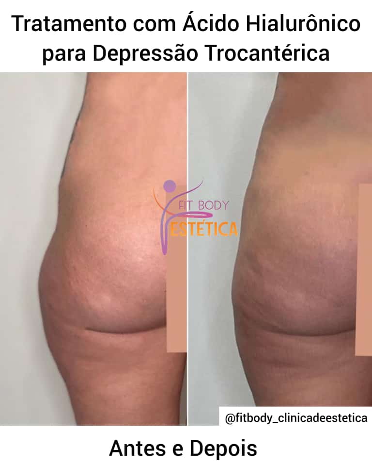 A Importância da Orientação Profissional na Escolha - inspiração 1