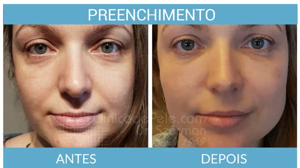 Ácido Glicólico: O Esfoliante Que Renova e Ilumina - inspiração 2