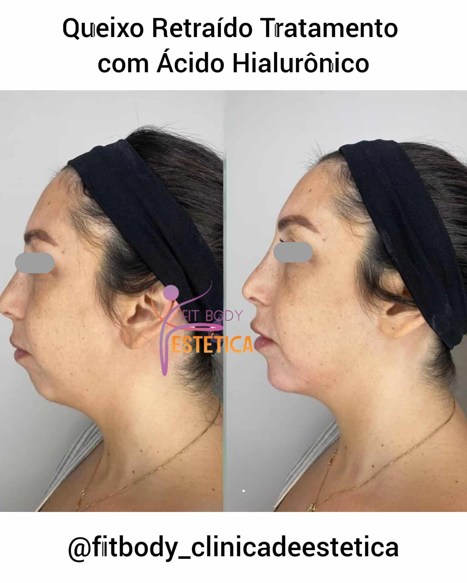 Diferenças Cruciais Entre os Tipos de Ácidos Mais Usados - inspiração 1