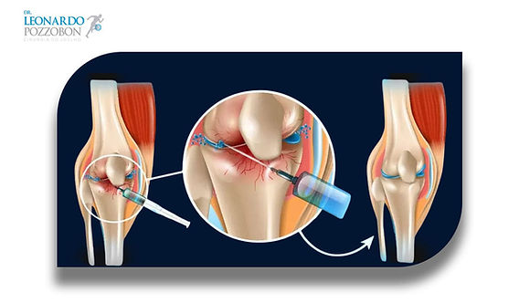 O Poder do Alongamento: Flexibilidade que Protege Suas Articulações - inspiração 1