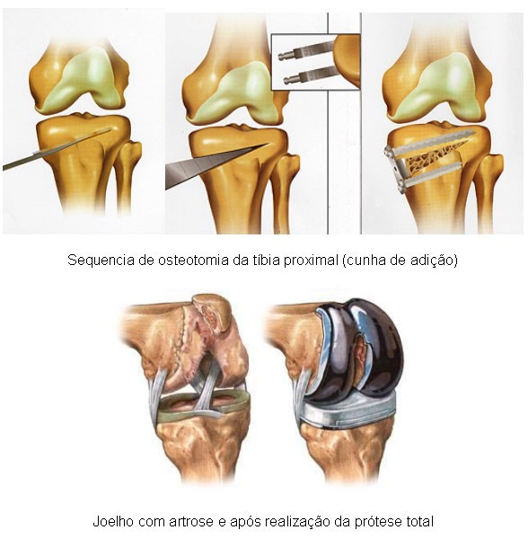 O Poder do Alongamento: Flexibilidade que Protege Suas Articulações - inspiração 2