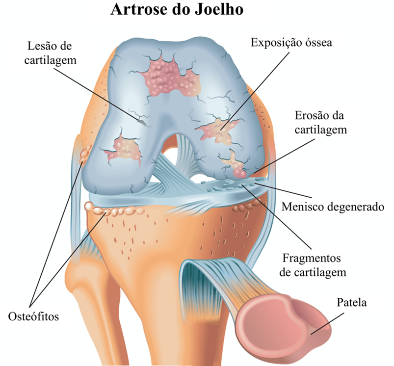 Alimentação que Cura: Nutrientes Essenciais para Articulações Saudáveis - inspiração 2