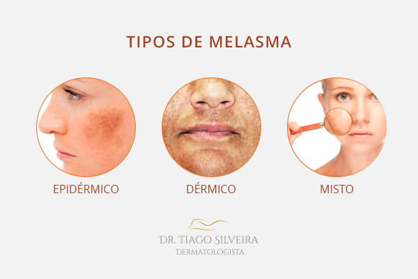 Tratamentos Tópicos: Cremes Que Fazem a Diferença - inspiração 2