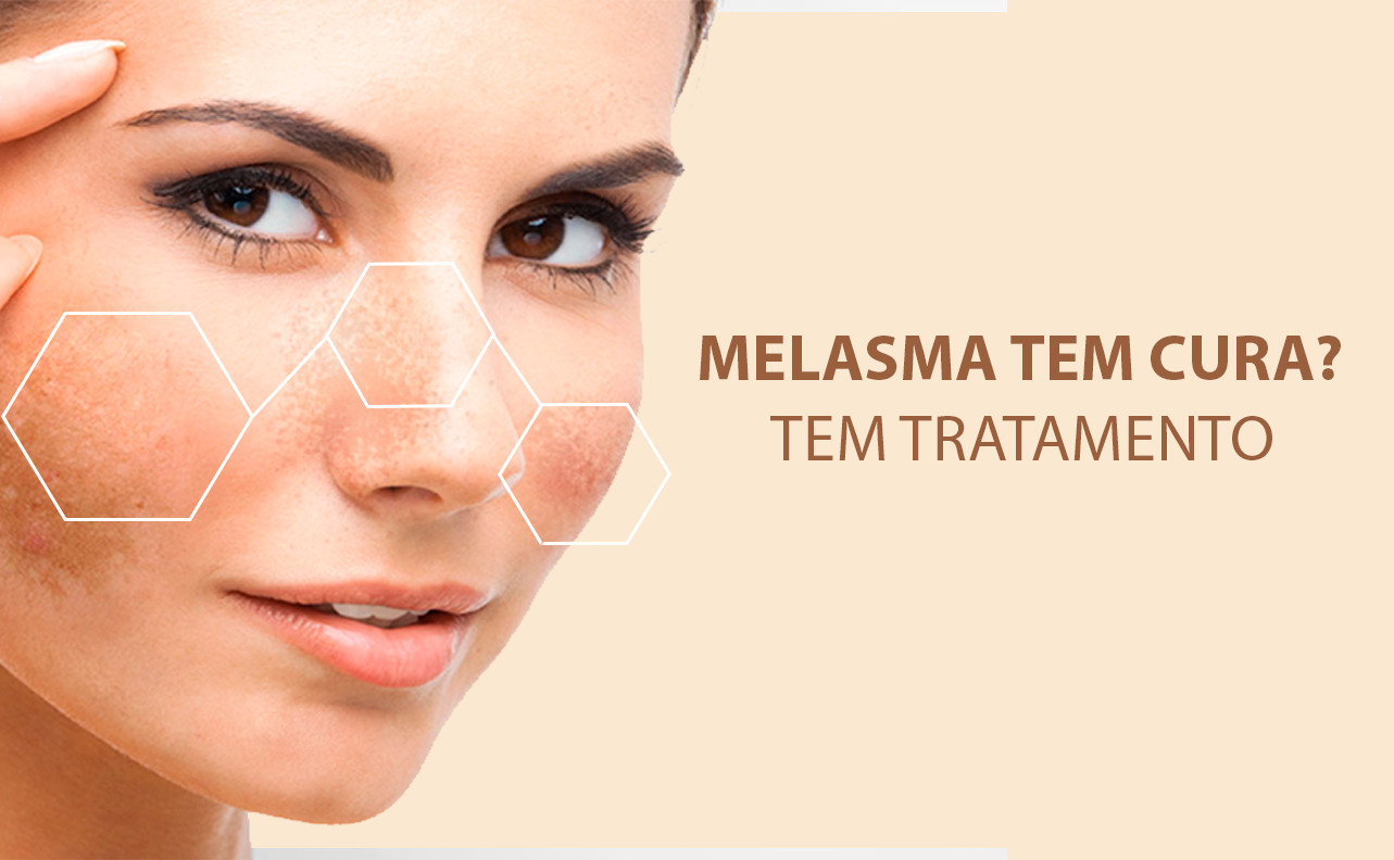 O Poder do Protetor Solar: Seu Melhor Amigo Diário - inspiração 1