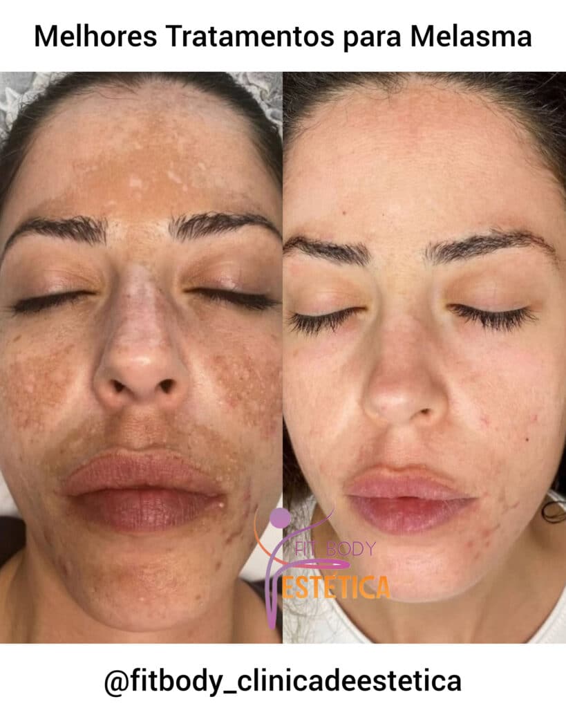 Cuidados em Casa: Rotina Que Realmente Funciona - inspiração 1