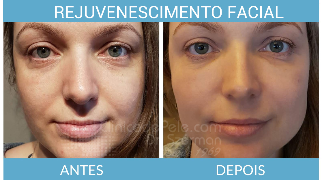 Entendendo a Ciência Por Trás da Pele Jovem - inspiração 2