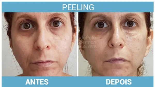 Quando Procurar Ajuda Profissional: Dermatologistas e Esteticistas - inspiração 1