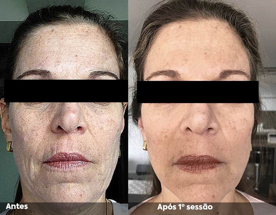 Quando Procurar Ajuda Profissional: Dermatologistas e Esteticistas - inspiração 2