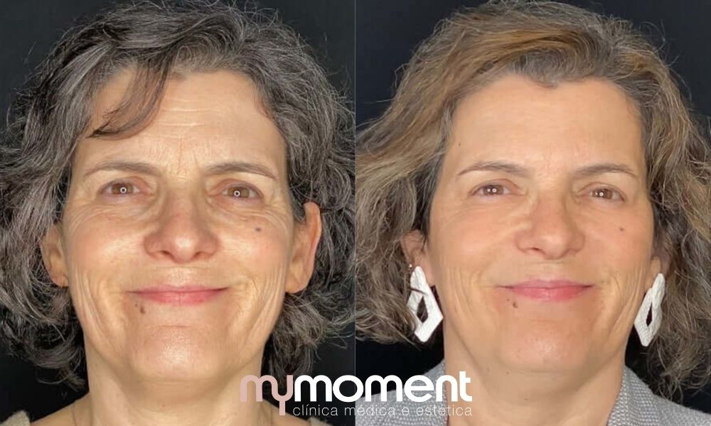 Tratamentos Tópicos: Do Essencial ao Avançado - inspiração 1