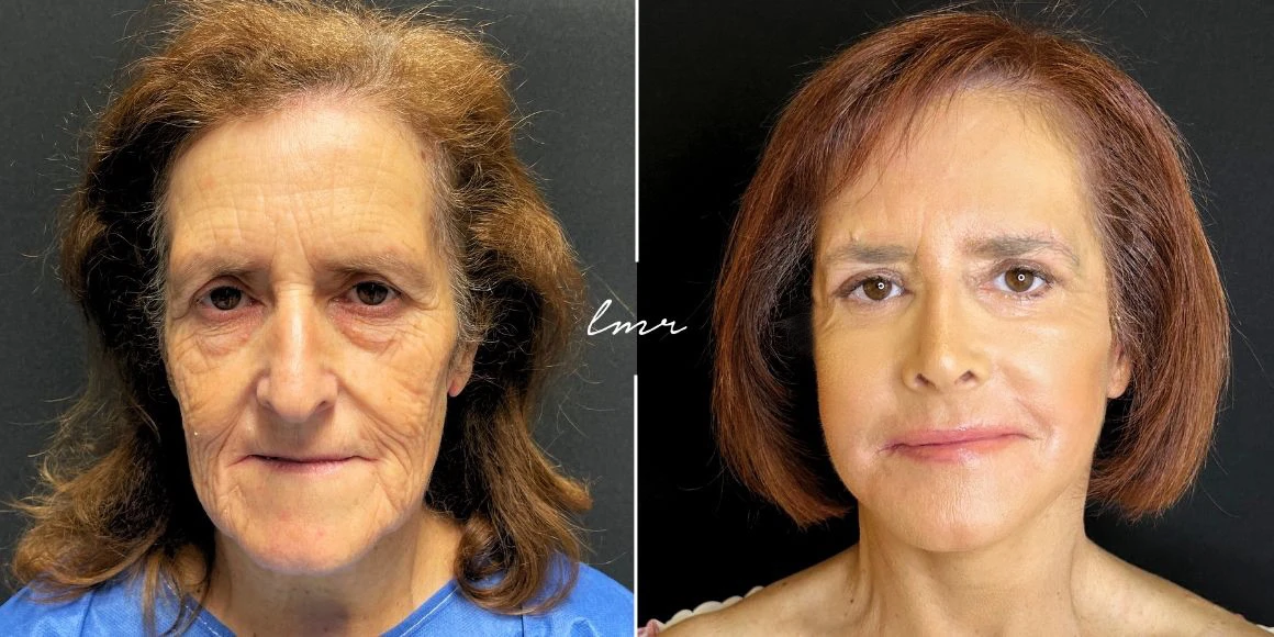 O Poder dos Procedimentos Estéticos: Uma Visão Detalhada - inspiração 1