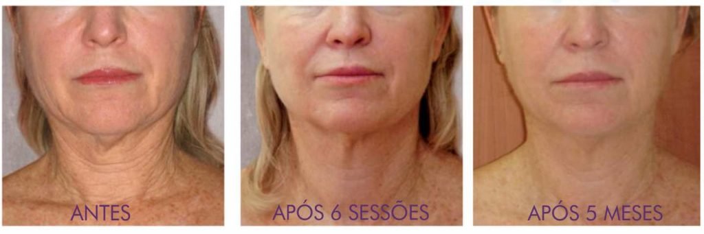 Estilo de Vida e Bem-Estar: Impacto Direto na Sua Aparência - inspiração 2