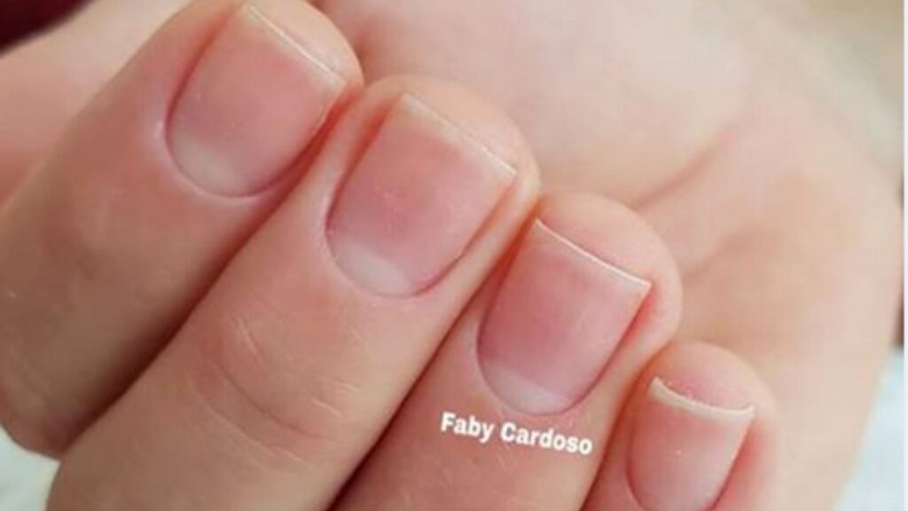 Hidratação Profunda: O Ingrediente Secreto para Flexibilidade - inspiração 2