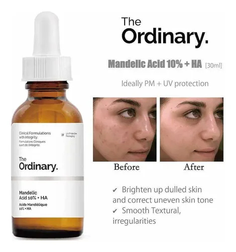 Produtos com Ácido Mandélico: o que procurar? - inspiração 2