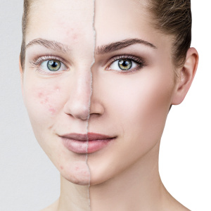 Efeitos Colaterais Comuns e Como Lidar com Eles - inspiração 2