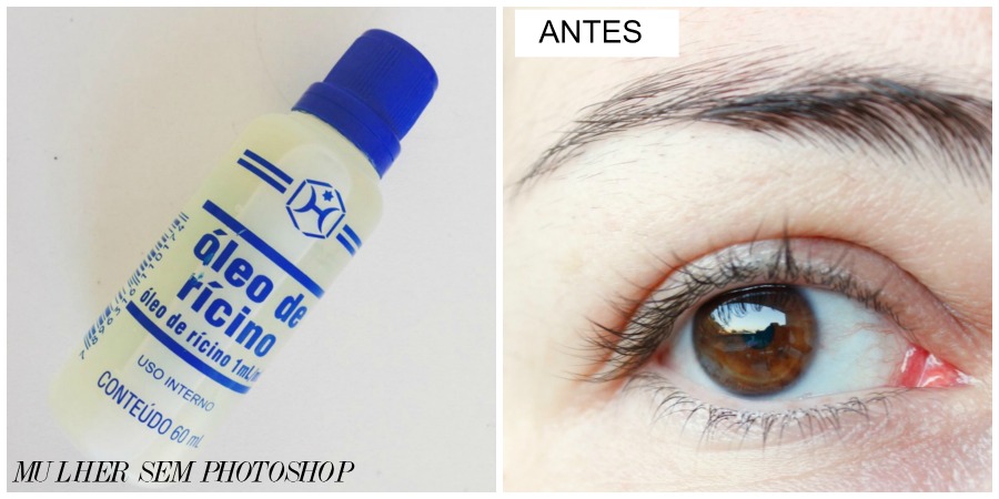 Como Escolher o Melhor Óleo de Rícino Puro para Seus Cuidados Capilares