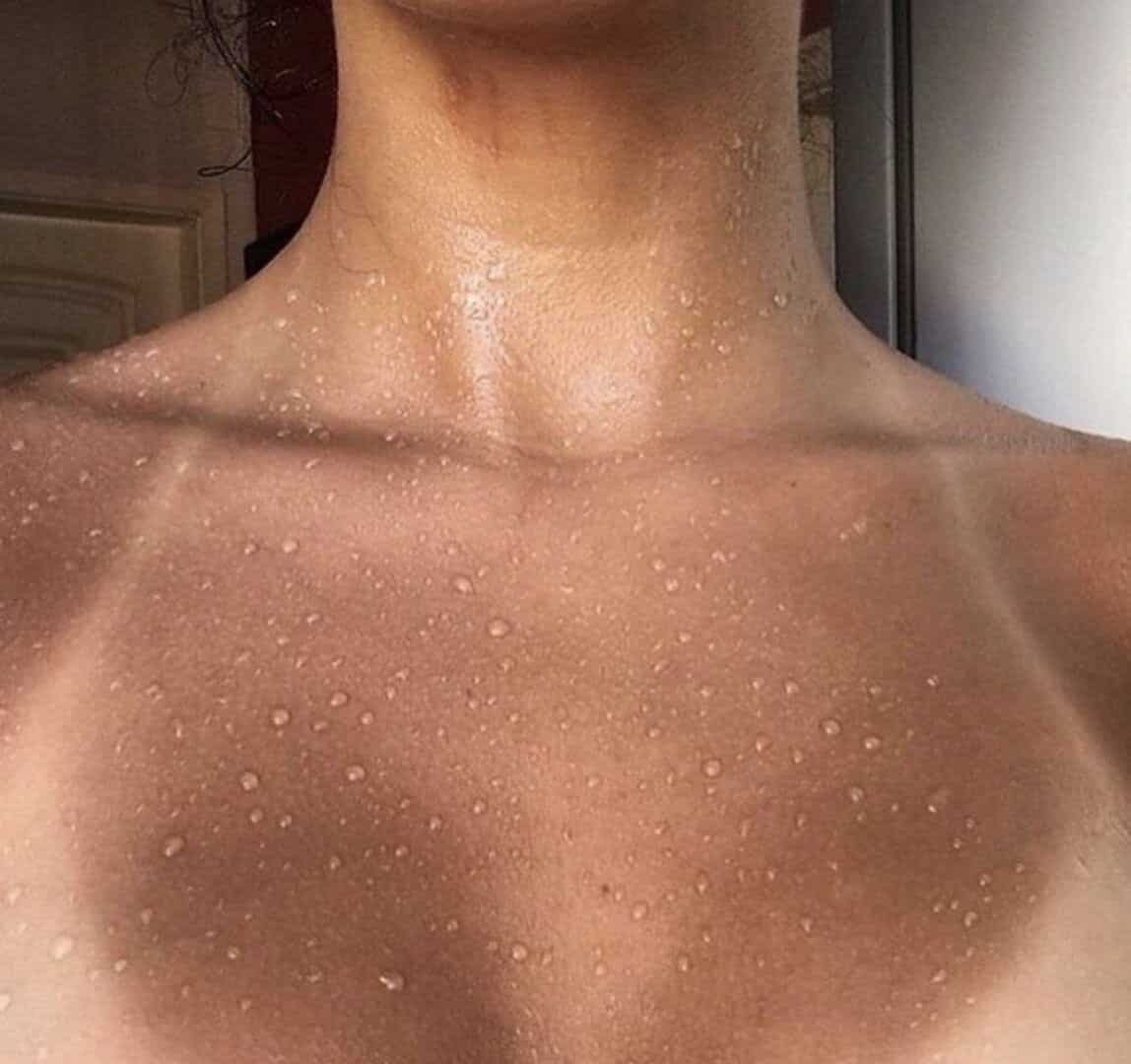 Bronzeado Saudável: Mitos e Verdades sobre a Exposição ao Sol