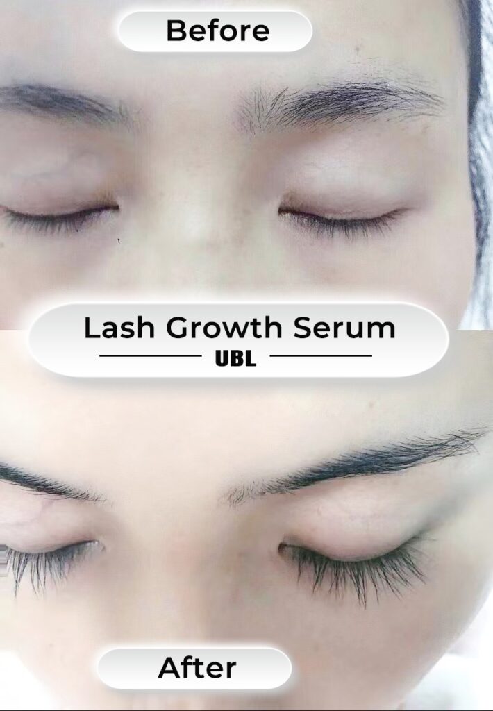 Mitos e Verdades sobre o Uso Diário do Curvex: Cuidados Essenciais