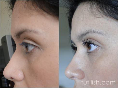 Mitos e Verdades sobre o Uso Diário do Curvex: Cuidados Essenciais