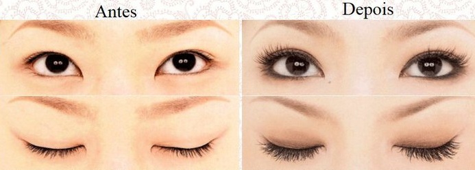 Saúde dos Cílios: Como Evitar Danos em Procedimentos Estéticos