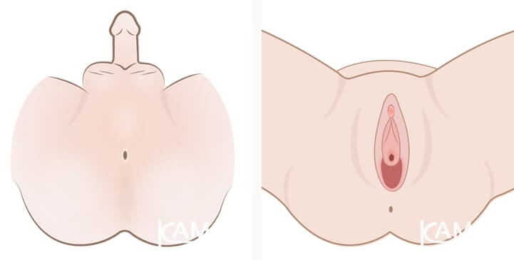 cirurgia de redesignação sexual antes e depois
