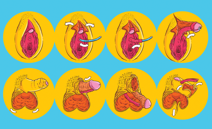 vaginoplastia antes e depois