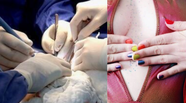 recuperação pós-cirurgia de redesignação sexual