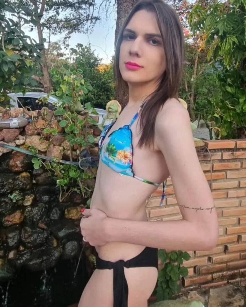 resultados cirurgia trans homem para mulher