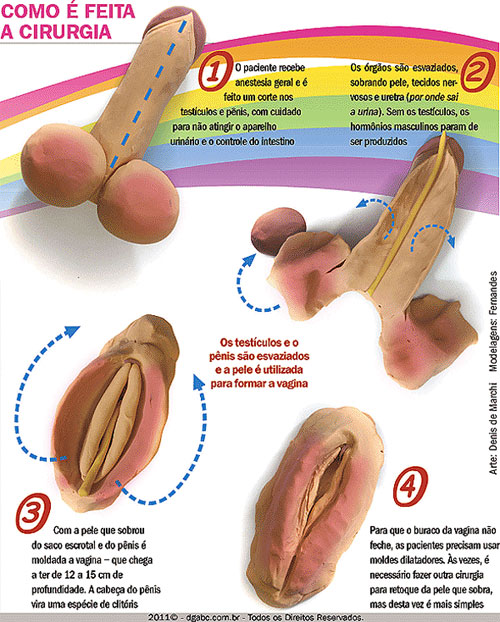 feminização facial antes e depois