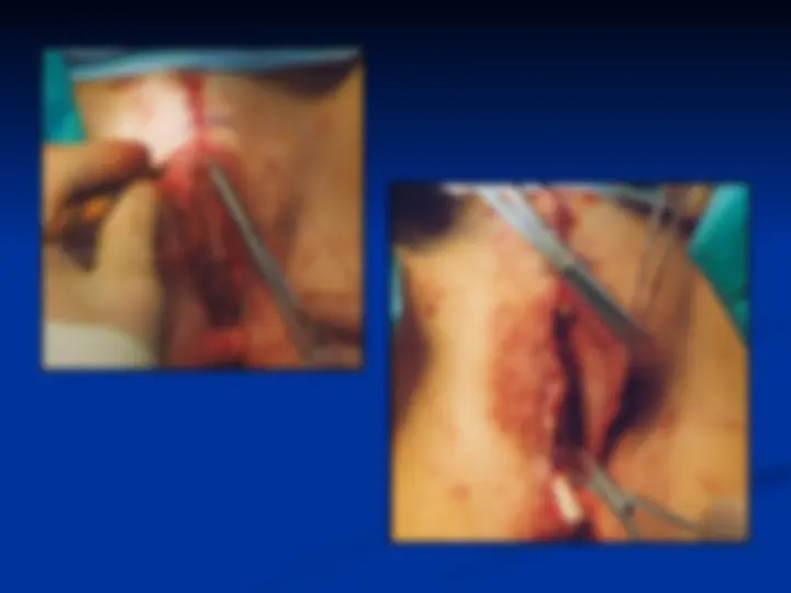 hospitais que realizam cirurgia de redesignação sexual pelo SUS