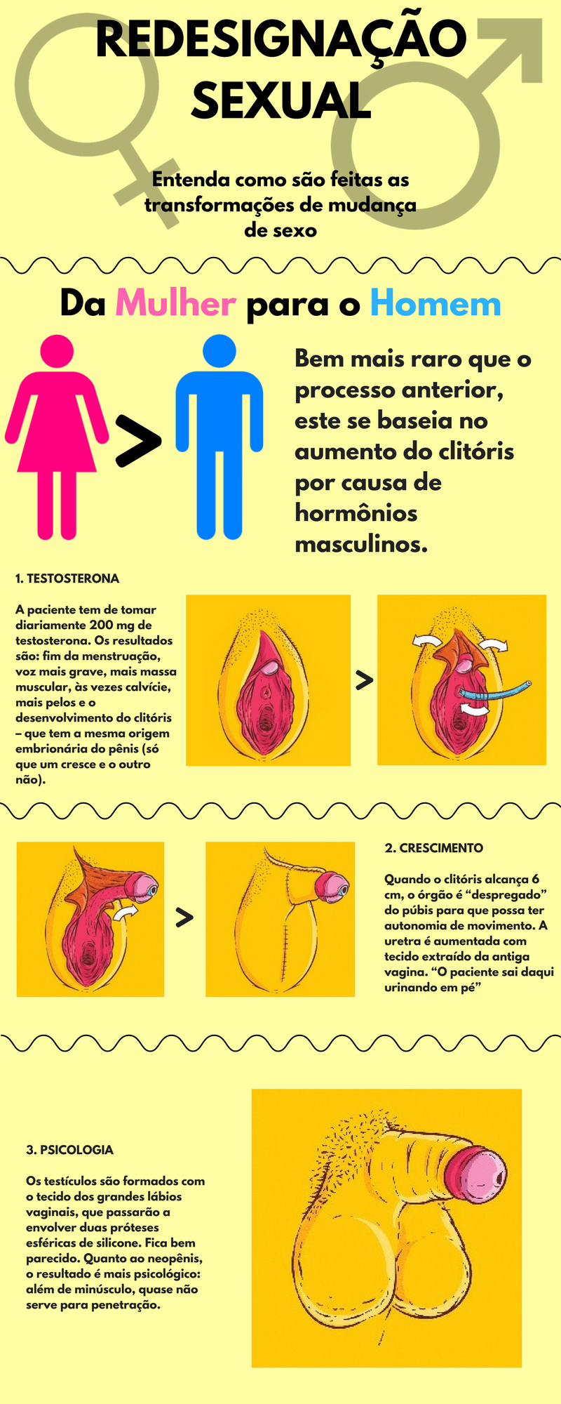 mudança de gênero homem para mulher cirurgia