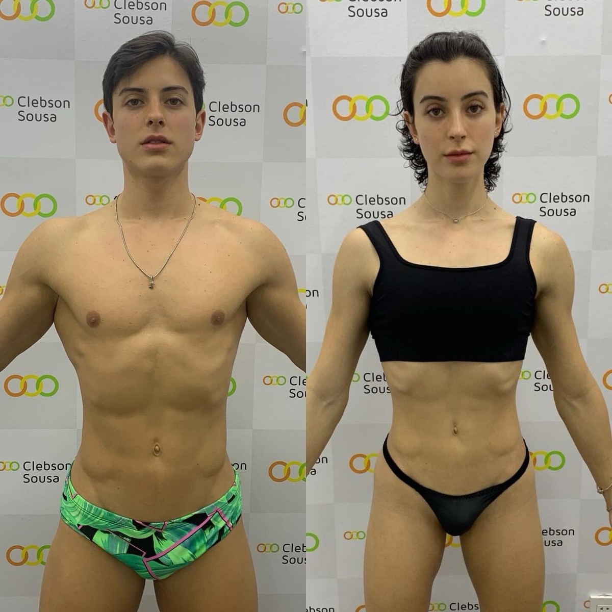 custo cirurgia de transição de gênero