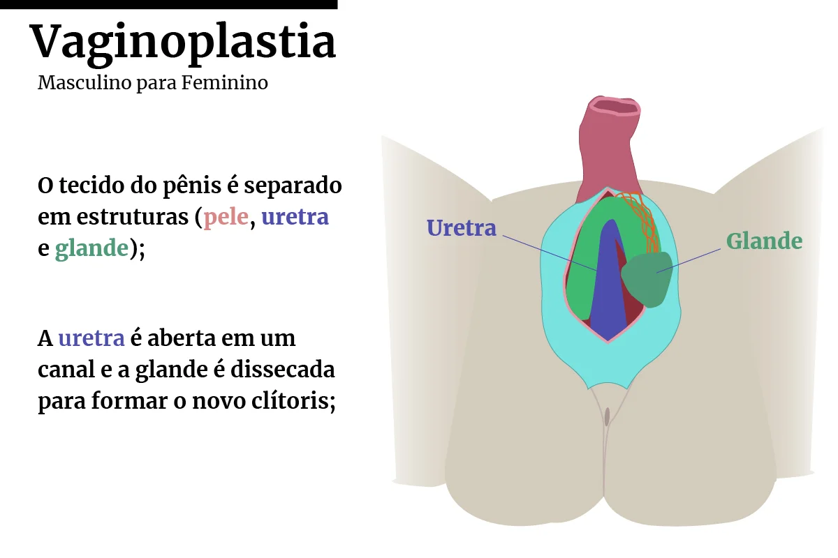 efeitos da terapia hormonal em mulheres trans