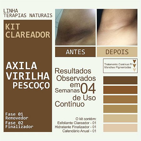 Depilação e Axilas Escuras: Métodos Menos Agressivos para Prevenir Manchas