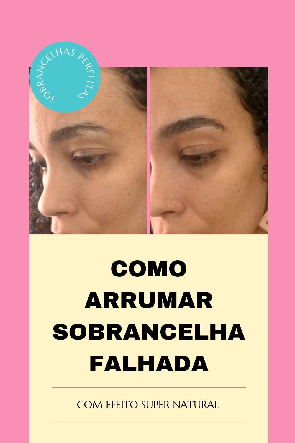 Botox na Sobrancelha: Solução para Assimetria e Arqueamento